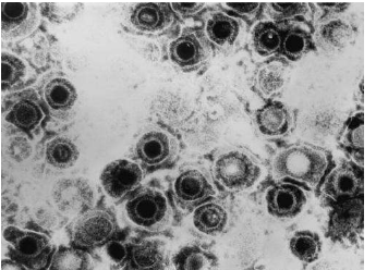 科学家利用基因编辑来破坏人类细胞中的潜伏性和活动性疱疹病毒 