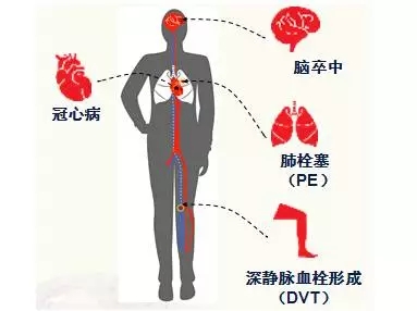 研究人员将使用数字技术帮助应对慢性病