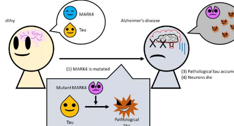 阿尔茨海默氏病的原因可追溯到常见酶的突变