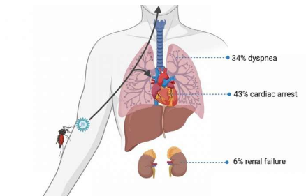 基孔肯雅热可能会影响中枢神经系统以及关节和肺