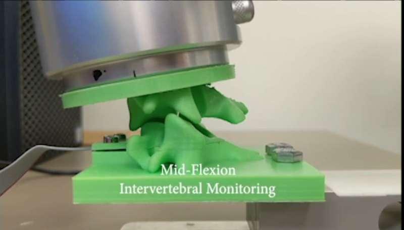 3D 机器人脊柱双胞胎和传感器提供了预览手术干预的新方法