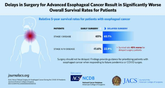 晚期食管癌手术延迟导致生存率明显低于早期手术