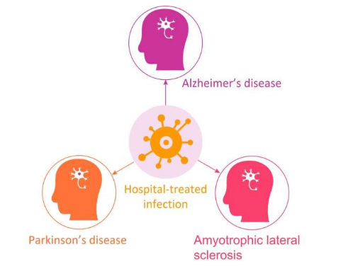 反复感染与某些神经退行性疾病的风险增加有关