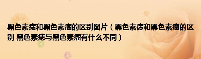 黑色素痣和黑色素瘤的区别图片（黑色素痣和黑色素瘤的区别 黑色素痣与黑色素瘤有什么不同）