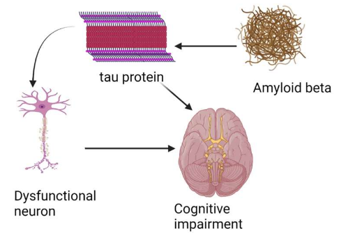 科学家在首次虚拟临床试验中对两种阿尔茨海默氏症药物进行了正面对比