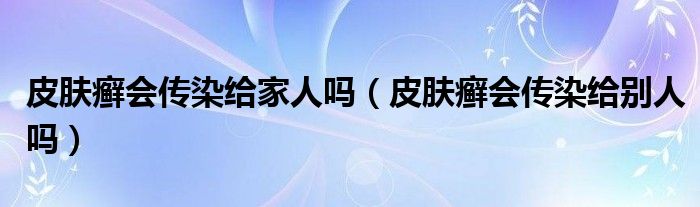 皮肤癣会传染给家人吗（皮肤癣会传染给别人吗）