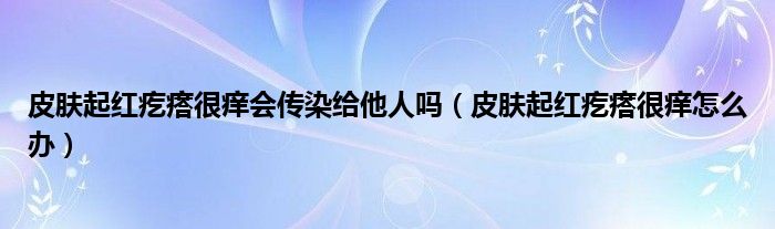 皮肤起红疙瘩很痒会传染给他人吗（皮肤起红疙瘩很痒怎么办）