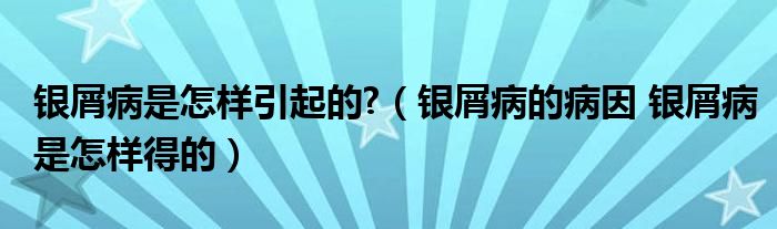 银屑病是怎样引起的?（银屑病的病因 银屑病是怎样得的）