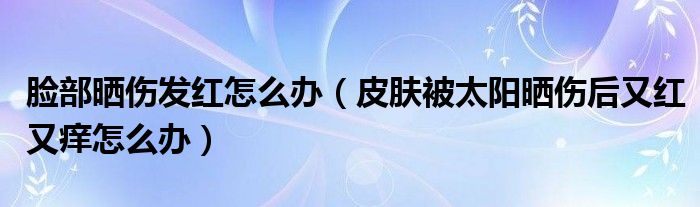 脸部晒伤发红怎么办（皮肤被太阳晒伤后又红又痒怎么办）