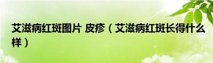 艾滋病红斑图片 皮疹（艾滋病红斑长得什么样）