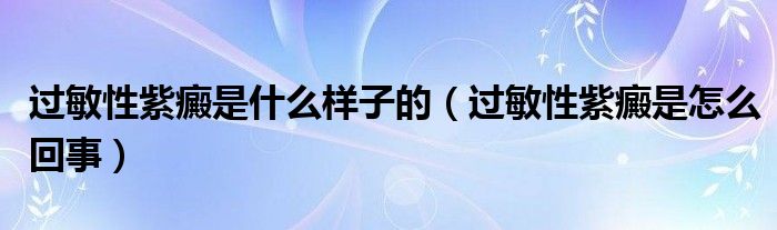 过敏性紫癜是什么样子的（过敏性紫癜是怎么回事）