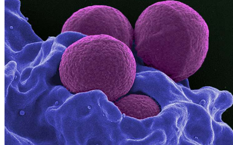 葡萄球菌如何在生物环境中传播