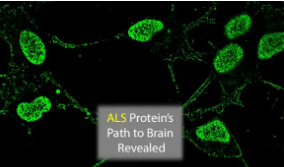 ALS蛋白进入大脑的路径已记录