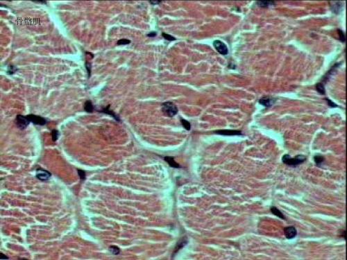 研究人员发现由干细胞产生的骨骼肌